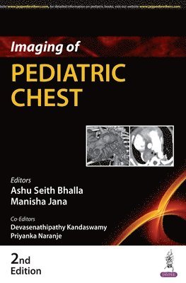 bokomslag Imaging of Pediatric Chest