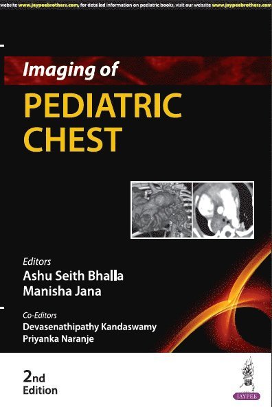 Ashu Seith Bhalla, Manisha Jana, Devasenathipathy Kandaswamy, Priyanka Naranje - Imaging of Pediatric Chest, Häftad