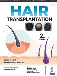 bokomslag Hair Transplantation