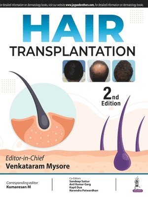 bokomslag Hair Transplantation