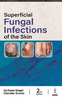bokomslag Superficial Fungal Infections of the Skin