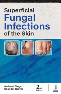 bokomslag Superficial Fungal Infections of the Skin