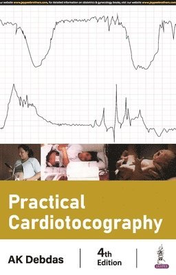 AK Debdas - Practical Cardiotocography, Häftad