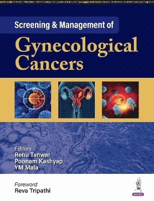 Renu Tanwar, Poonam Kashyap, YM Mala - Screening & Management of Gynecological Cancers, Häftad
