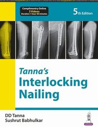 bokomslag Tannas Interlocking Nailing