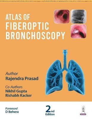 Rajendra Prasad - Atlas of Fiberoptic Bronchoscopy, Inbunden