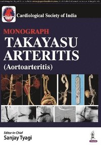 bokomslag Takayasu Arteritis (Aortoarteritis)