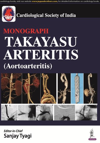 Sanjay Tyagi, Debabrata Roy, George Joseph - Takayasu Arteritis (Aortoarteritis), Inbunden