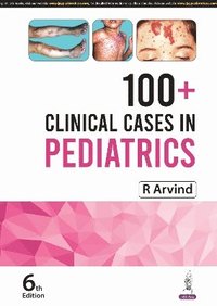 bokomslag 100+ Clinical Cases in Pediatrics