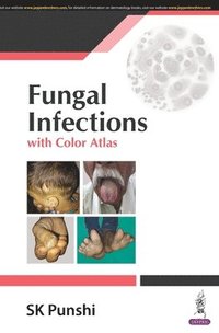 bokomslag Fungal Infections