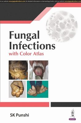 Fungal Infections 1