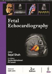bokomslag Fetal Echocardiography