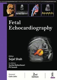 bokomslag Fetal Echocardiography