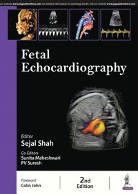 bokomslag Fetal Echocardiography