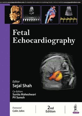 bokomslag Fetal Echocardiography