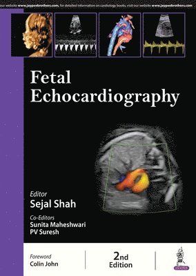 Fetal Echocardiography 1