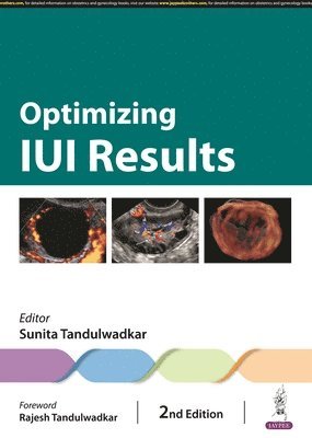 Sunita Tandulwadkar - Optimizing IUI Results, Inbunden