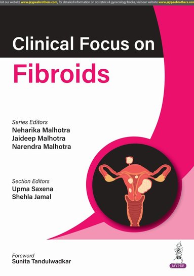 Neharika Malhotra, Jaideep Malhotra, Narendra Malhotra, Upma Saxena, Shehla Jamal - Clinical Focus on Fibroids, Häftad