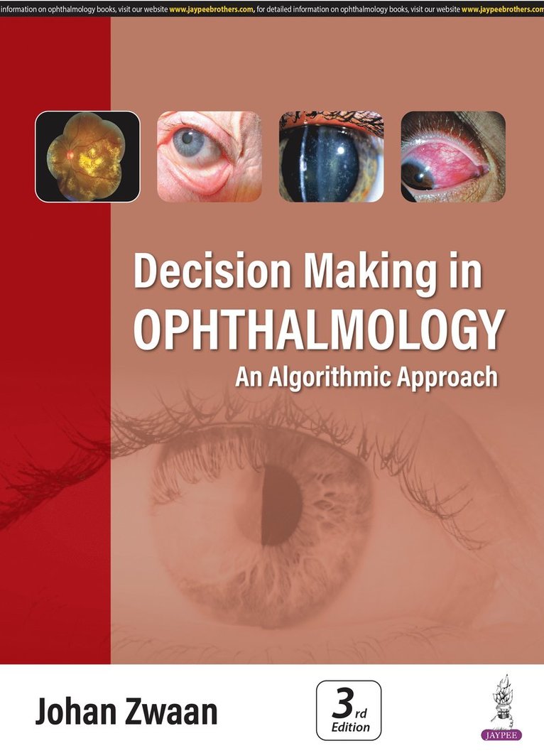 Johan Zwaan - Decision Making in Ophthalmology, Häftad