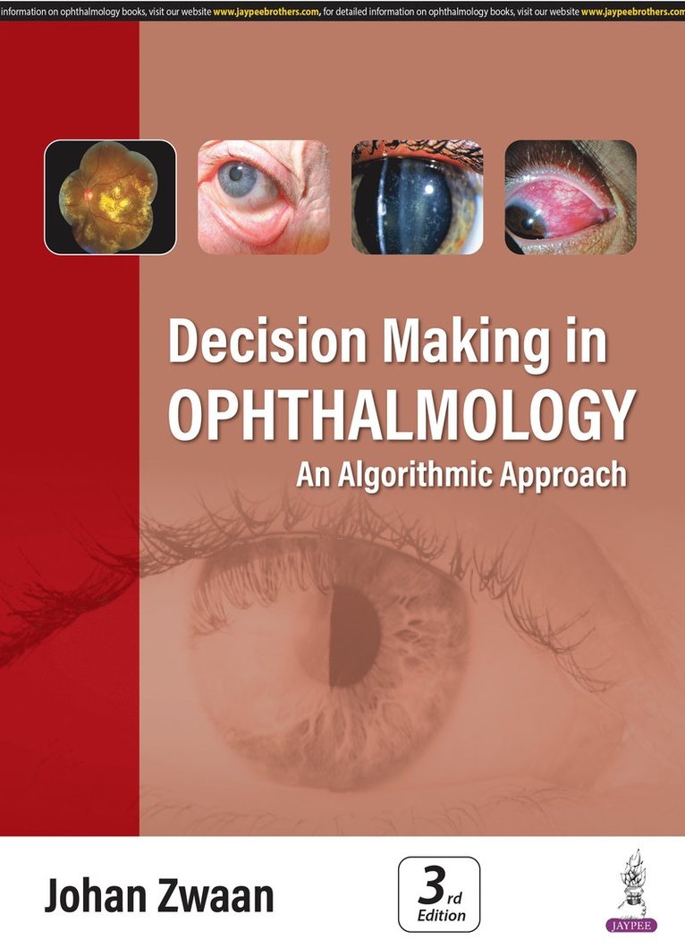 Decision Making in Ophthalmology 1