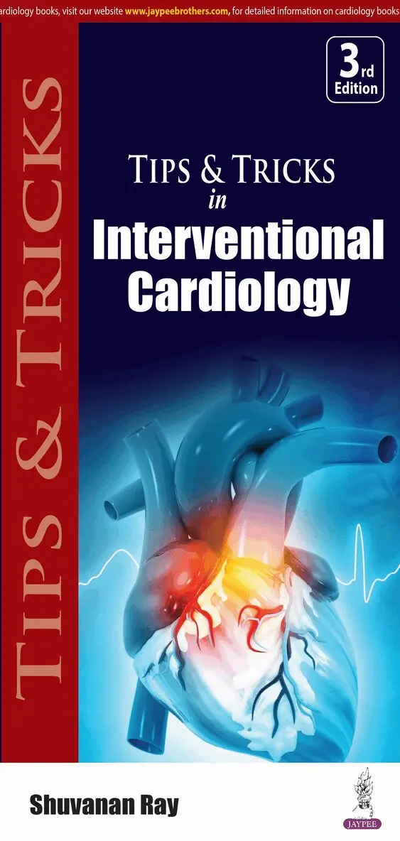 Shuvanan Ray - Tips & Tricks in Interventional Cardiology, Häftad. Tillgänglighet: Lägg i varukorg