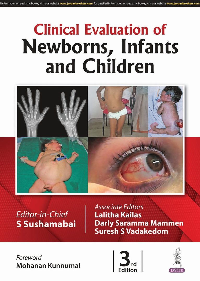 Clinical Evaluation of Newborns, Infants and Children