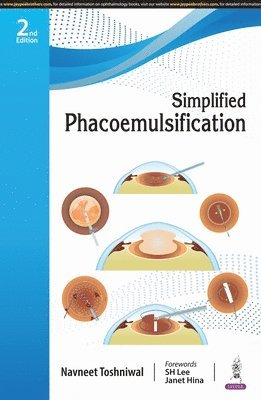 bokomslag Simplified Phacoemulsification