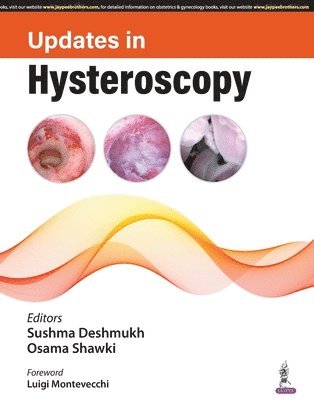 bokomslag Updates in Hysteroscopy