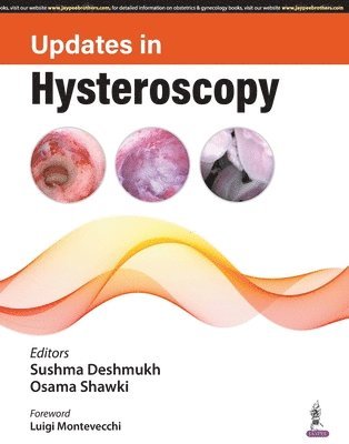 Updates in Hysteroscopy 1