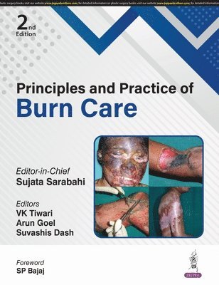 bokomslag Principles and Practice of Burn Care