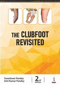 bokomslag The Clubfoot Revisited