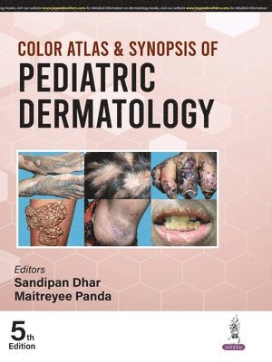 bokomslag Color Atlas & Synopsis of Pediatric Dermatology