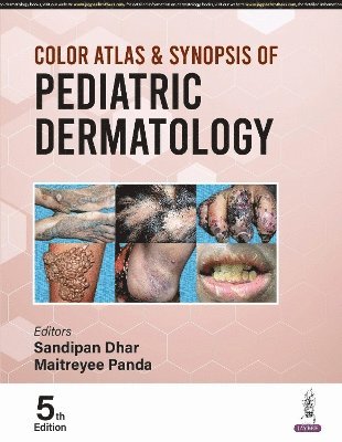 Color Atlas & Synopsis of Pediatric Dermatology