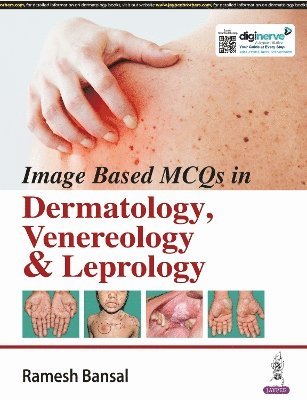 bokomslag Image Based MCQs in Dermatology, Venereology & Leprology