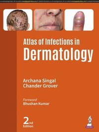 bokomslag Atlas of Infections in Dermatology