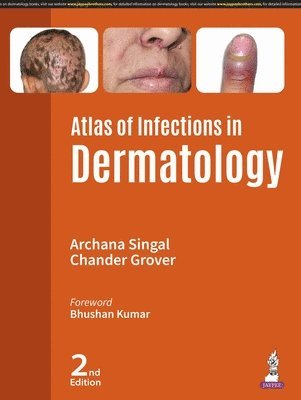 Atlas of Infections in Dermatology 1