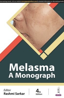 bokomslag Melasma