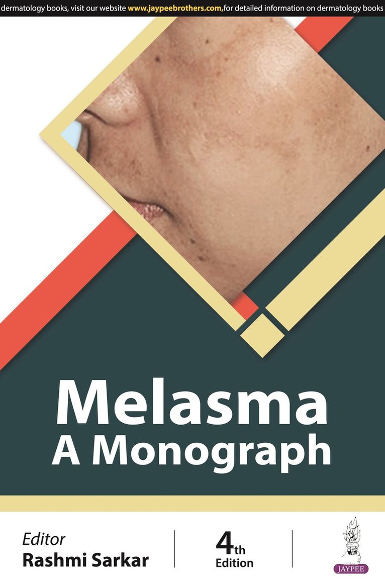 Rashmi Sarkar - Melasma, Häftad