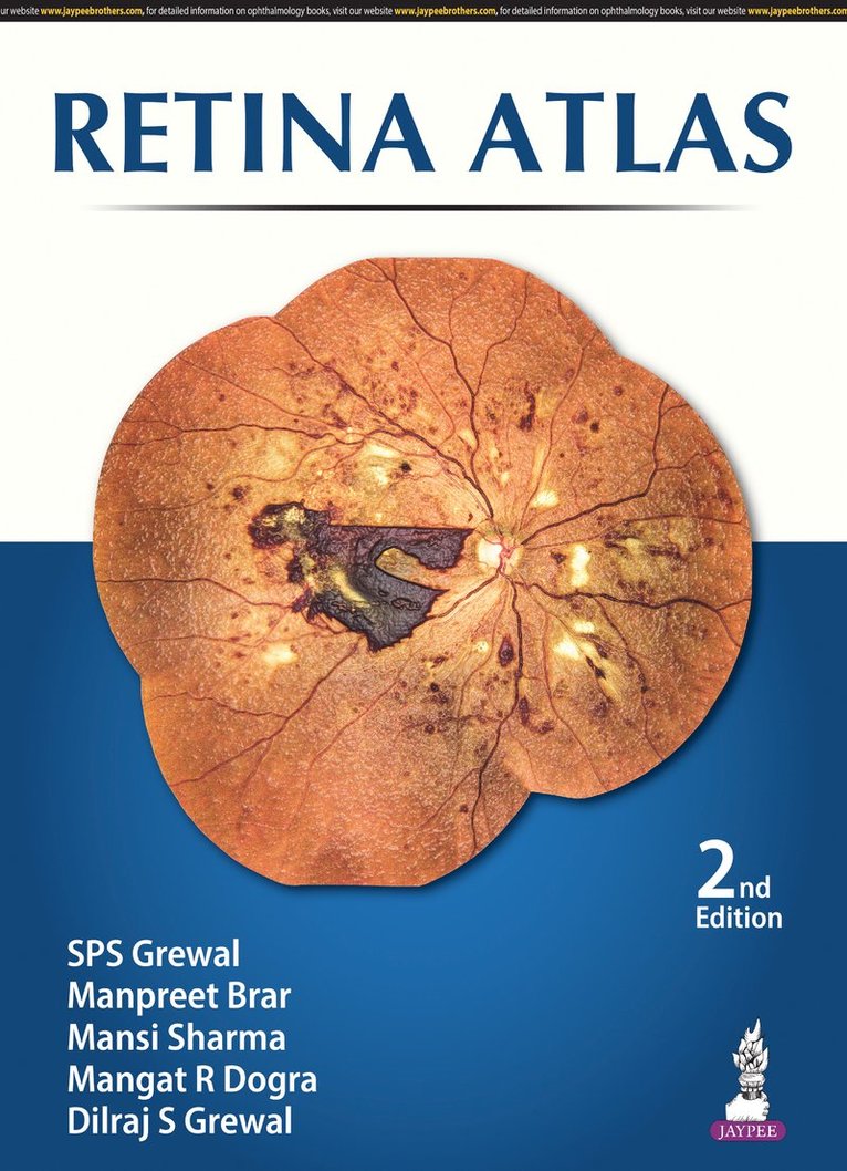 Retina Atlas 1