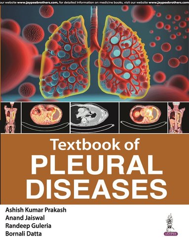 Ashish Kumar Prakash, Anand Jaiswal, Randeep Guleria, Bornali Datta - Textbook of Pleural Diseases, Inbunden