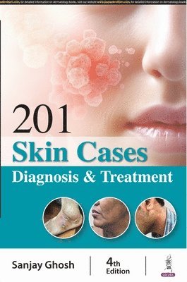 Sanjay Ghosh - 201 Skin Cases, Häftad