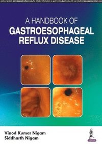 bokomslag A Handbook of Gastroesophageal Reflux Disease (GERD)