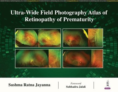 bokomslag Ultra-Wide Field Photography Atlas of Retinopathy of Prematurity