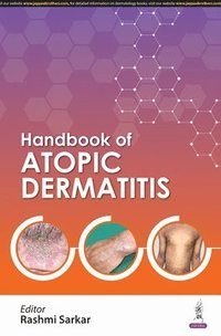 bokomslag Handbook of Atopic Dermatitis