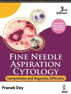 Fine Needle Aspiration Cytology 1