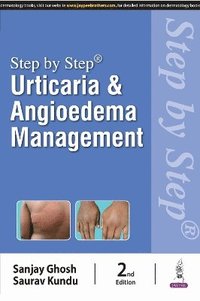 bokomslag Step by Step: Urticaria & Angioedema Management
