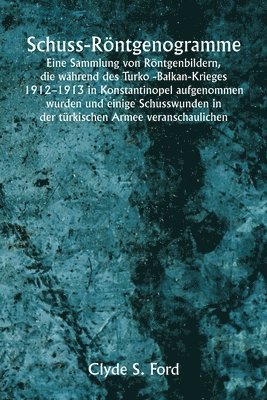 bokomslag Schuss-Röntgenogramme Eine Sammlung von Röntgenbildern, die während des Turko -Balkan-Krieges 1912-1913 in Konstantinopel aufgenommen wurden und einige Schusswunden in der türkischen Armee veransch...