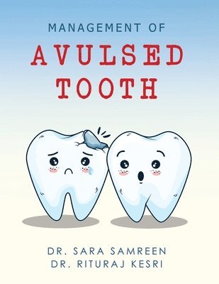 Management of Avulsed tooth 1