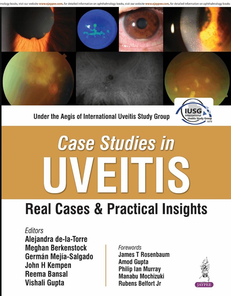 Alejandra De-la-Torre, Meghan Berkenstock, German Mejia-Salgado, John H Kempen, Reema Bansal, Vishali Gupta - Case Studies in Uveitis, Inbunden
