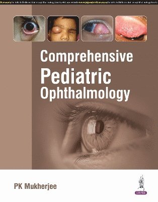 bokomslag Comprehensive Pediatric Ophthalmology
